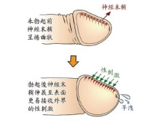 习惯性早泄要做哪些检查