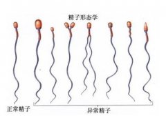 少精症是什么原因导致的